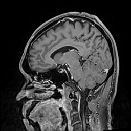 Click on the Serie image to view the images of VILLANUEVA, WILLIAM A.